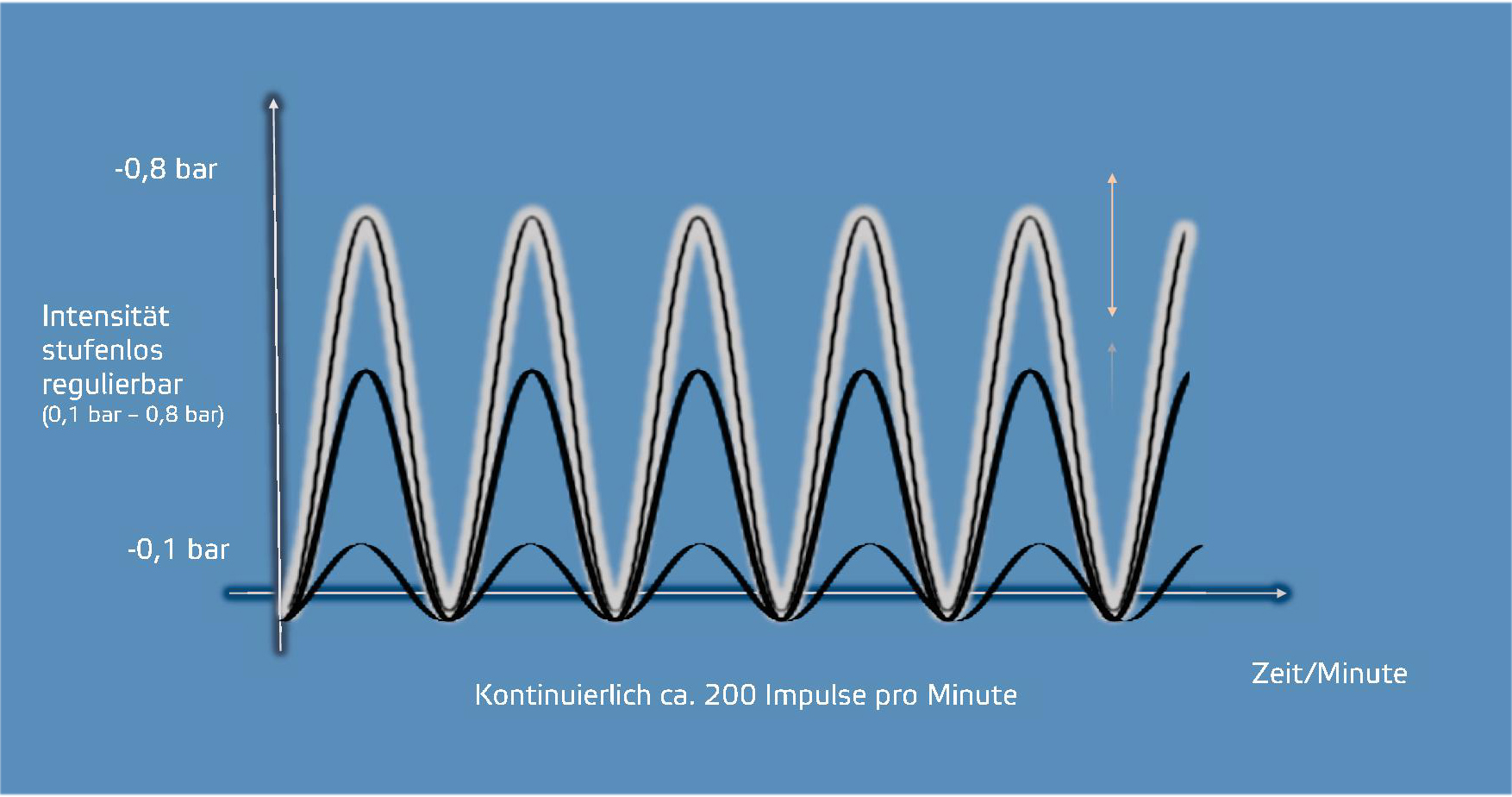 Pneumatische Pulsationstherapie